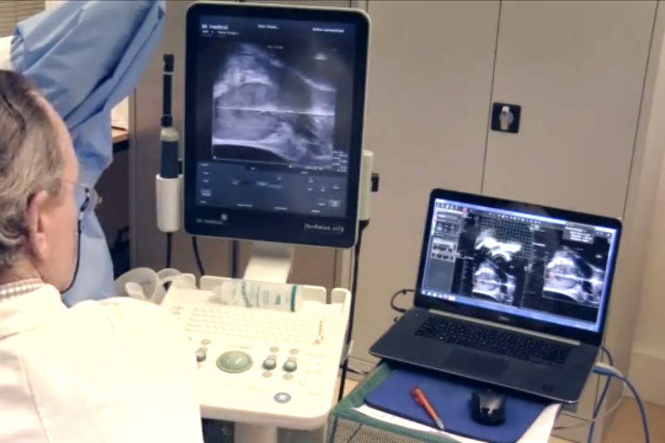 Bij fusie biopsie worden ’live’ echobeelden over de MRI-scan heengeschoven.